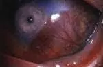 Konjunktivitis3